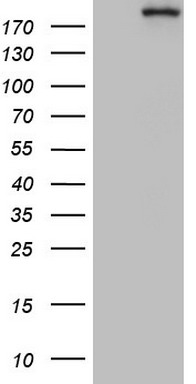 Desmin(DES) Antibody