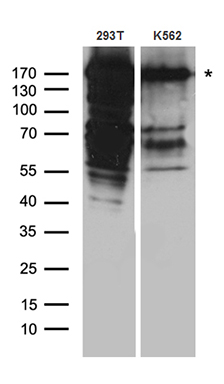 Desmoglein 1 Antibody