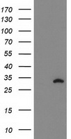 DSTN Antibody