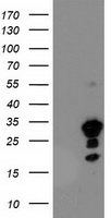 DSTN Antibody