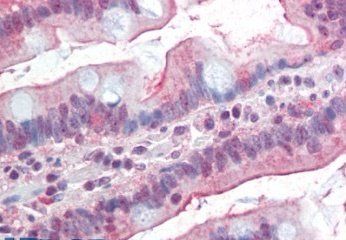 DGAT1 (aa67-79) Antibody