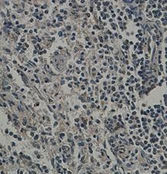 DGCR8 Rabbit Polyclonal Antibody