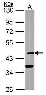 ASL Rabbit Polyclonal Antibody