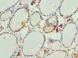 DHRS3 Antibody