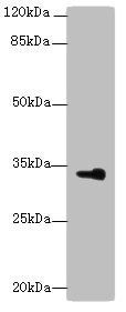 DHRS3 Antibody