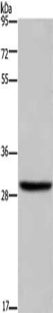 DHRS3 Antibody