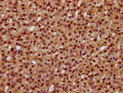 DHX38 Antibody