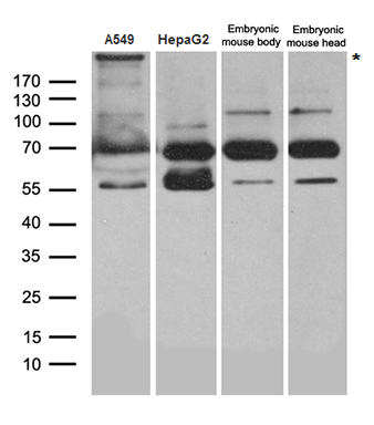 Dicer Antibody