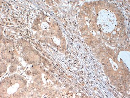 Rabbit Human DICER1 Antibody