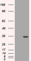 DIP13B Antibody