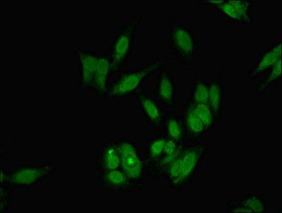 DKC1 Antibody