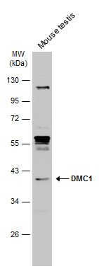 DMC1 antibody [N1C1]