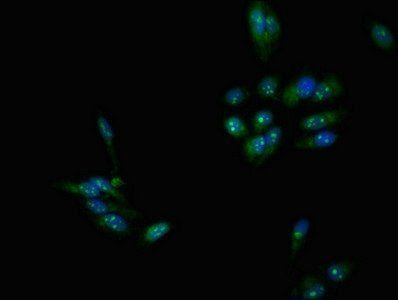 DMC1 Antibody