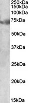 DMTF1 (isoform a) Antibody