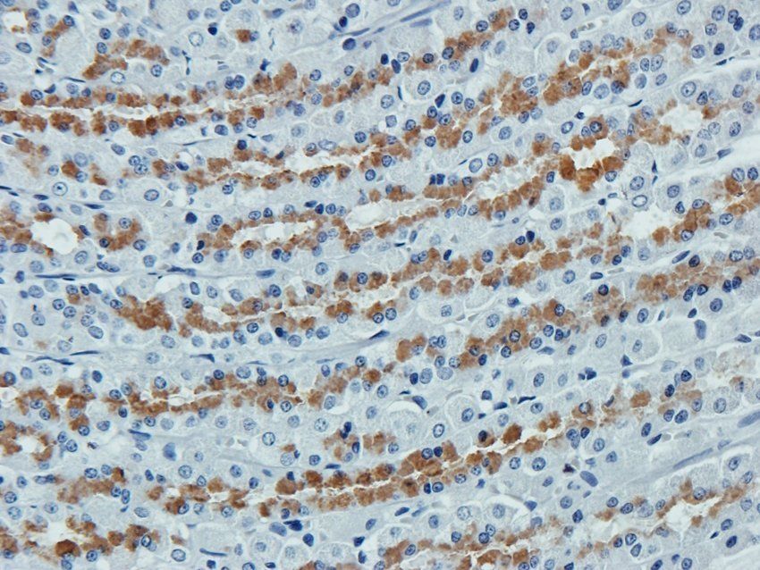 DNA polymerase theta Rabbit Polyclonal Antibody