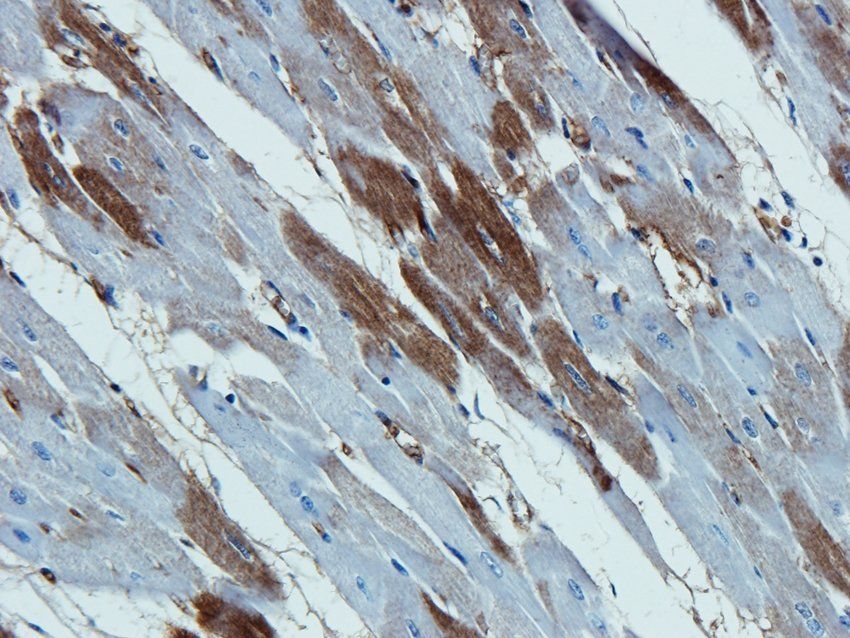 DNA polymerase theta Rabbit Polyclonal Antibody