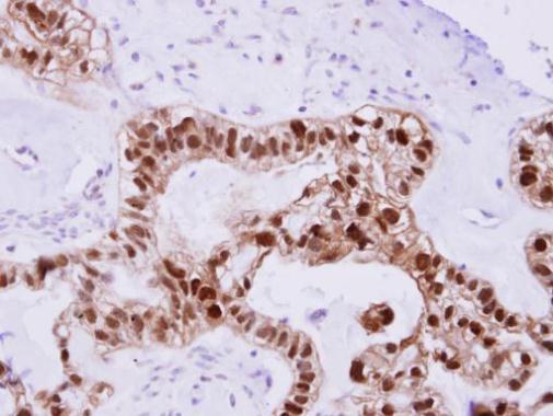 DNAJB2 Rabbit Polyclonal Antibody