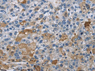 DNAJB4 Antibody