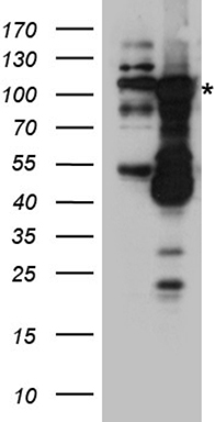 DNAJB6 Antibody