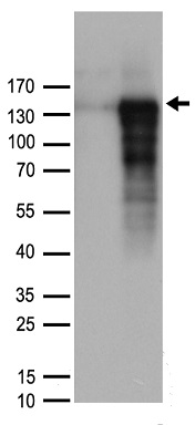 DNAJB6 Antibody