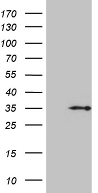 DNAJB6 Antibody