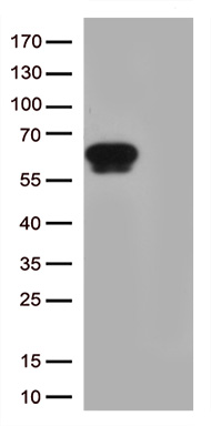 TRDMT1 Antibody