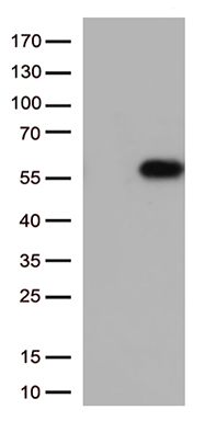 TRDMT1 Antibody
