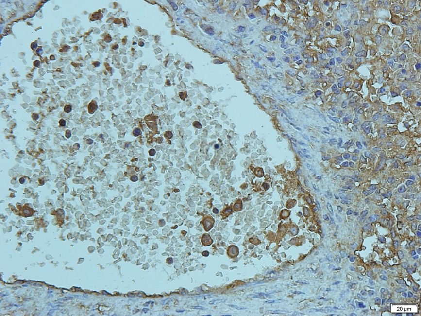 DOCK8 Rabbit Polyclonal Antibody