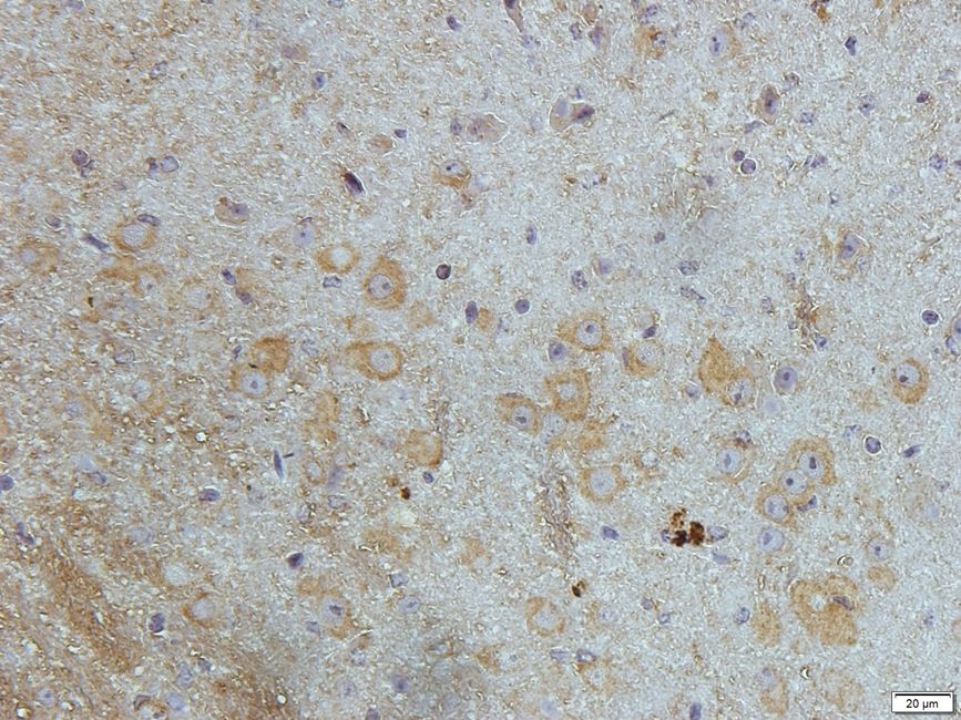 DOCK8 Rabbit Polyclonal Antibody