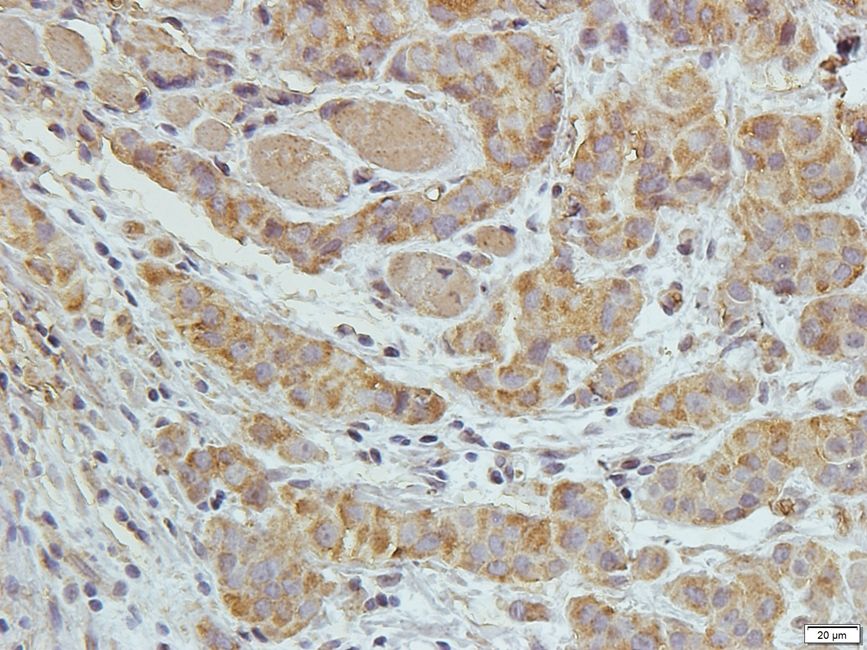 DOCK8 Rabbit Polyclonal Antibody