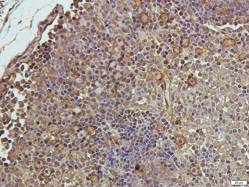 DOCK8 Rabbit Polyclonal Antibody