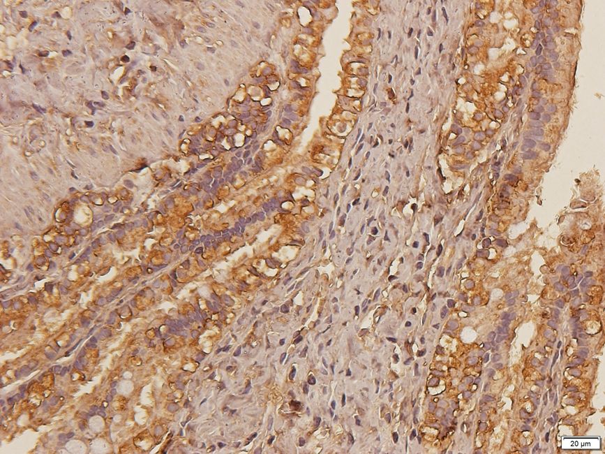 DOCK8 Rabbit Polyclonal Antibody