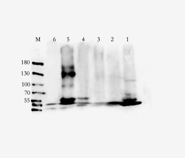 DOCK8 Rabbit Polyclonal Antibody