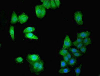 DOK1 Antibody