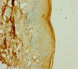 DOK1 Antibody