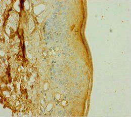 DOK1 Antibody