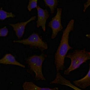 DOK1 Antibody