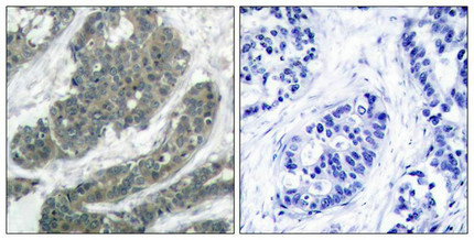 DOK1 Antibody