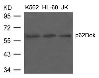 DOK1 Antibody
