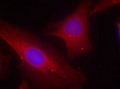 DOK2 Antibody