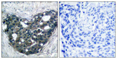 DOK2 Antibody