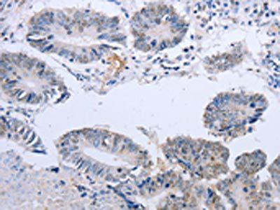 DOK5 Antibody