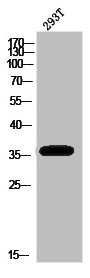 DOK5 Antibody