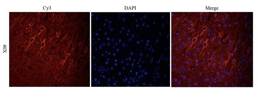Dopamine D2 receptor Rabbit Polyclonal Antibody