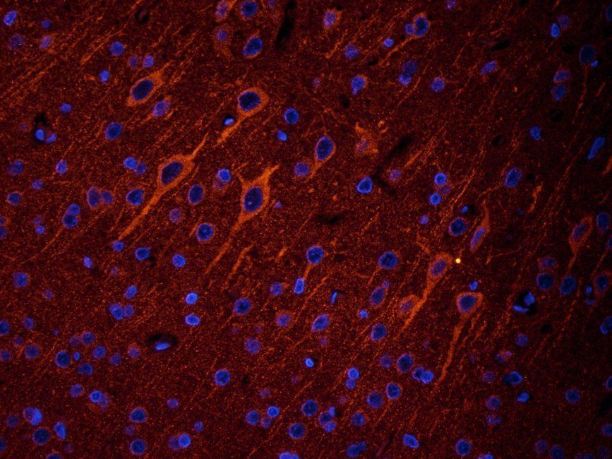 Dopamine D2 receptor Rabbit Polyclonal Antibody