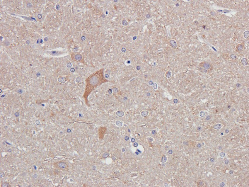 Dopamine D2 receptor Rabbit Polyclonal Antibody