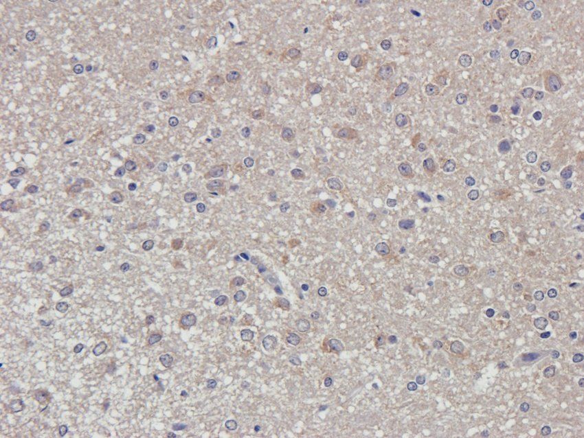 Dopamine D2 receptor Rabbit Polyclonal Antibody