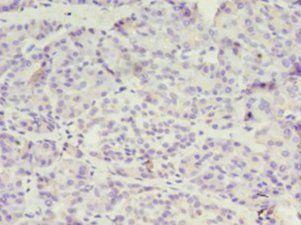 DPH1 Antibody