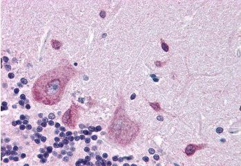 Dipeptidylpeptidase 10 Antibody