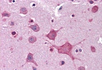 Dipeptidylpeptidase 10 Antibody